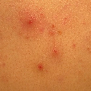 telemedicine image 3